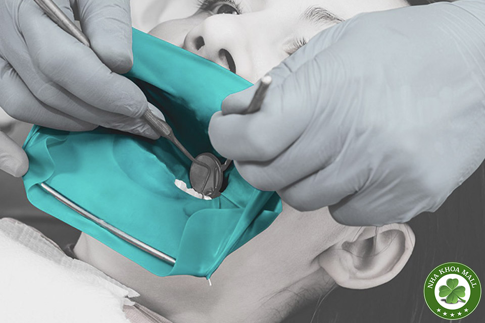 Giải pháp cô lập răng với Bộ đặt đê cao su – Bước tiến quan trọng trong nha khoa hiện đại