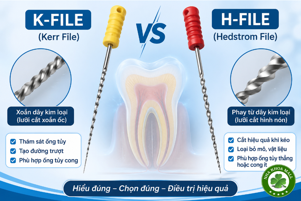 K-file và H-file trong nội nha: So sánh cấu tạo, cơ chế cắt và cách lựa chọn