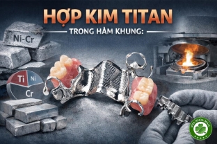 Góc nhìn thực tế về “hợp kim Titan” trong hàm khung - Những nhầm lẫn bác sĩ cần biết