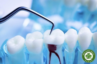 Vì sao cần điều trị nội nha? Giải pháp cứu răng hiệu quả