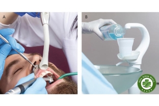 Tầm quan trọng của việc vệ sinh hệ thống hút nước bọt trong nha khoa