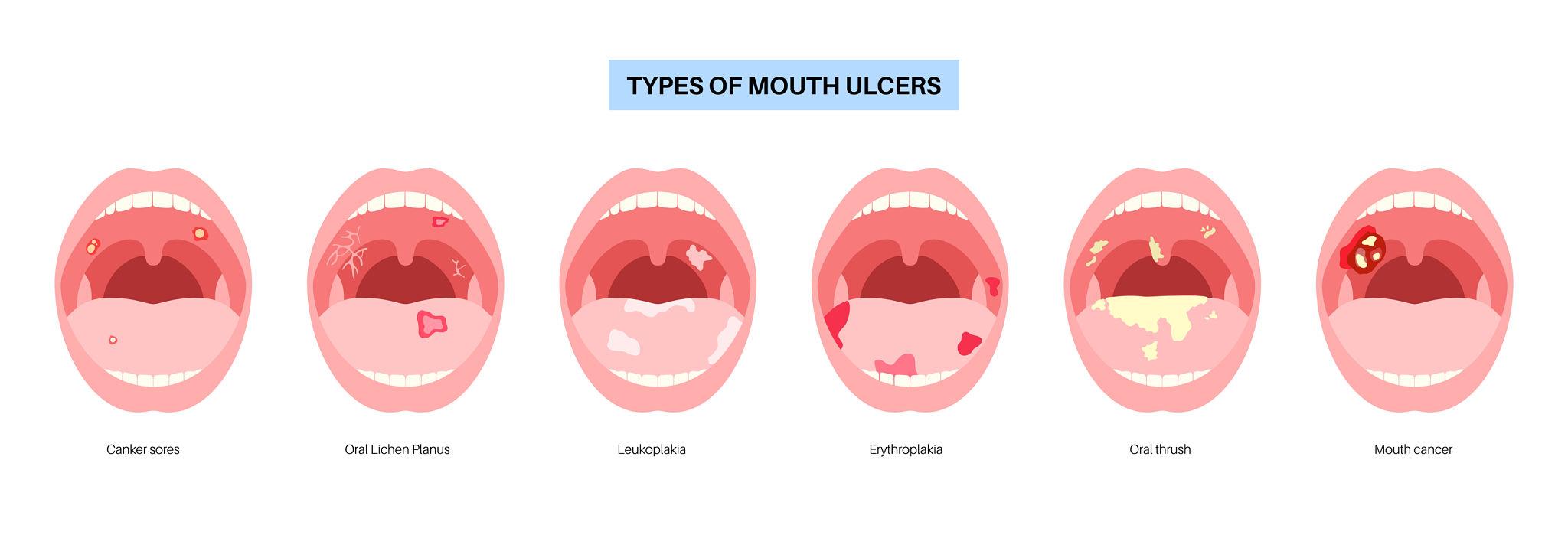 Giải phẫu bệnh miệng không chỉ là việc gọi tên các tổn thương mà là học cách quan sát và nhận diện chúng