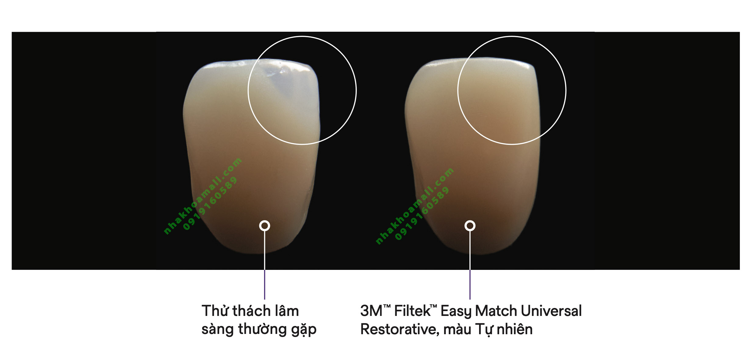 Composite đặc trám răng thẩm mỹ 3M Filtek Easy Match Universal Restorative