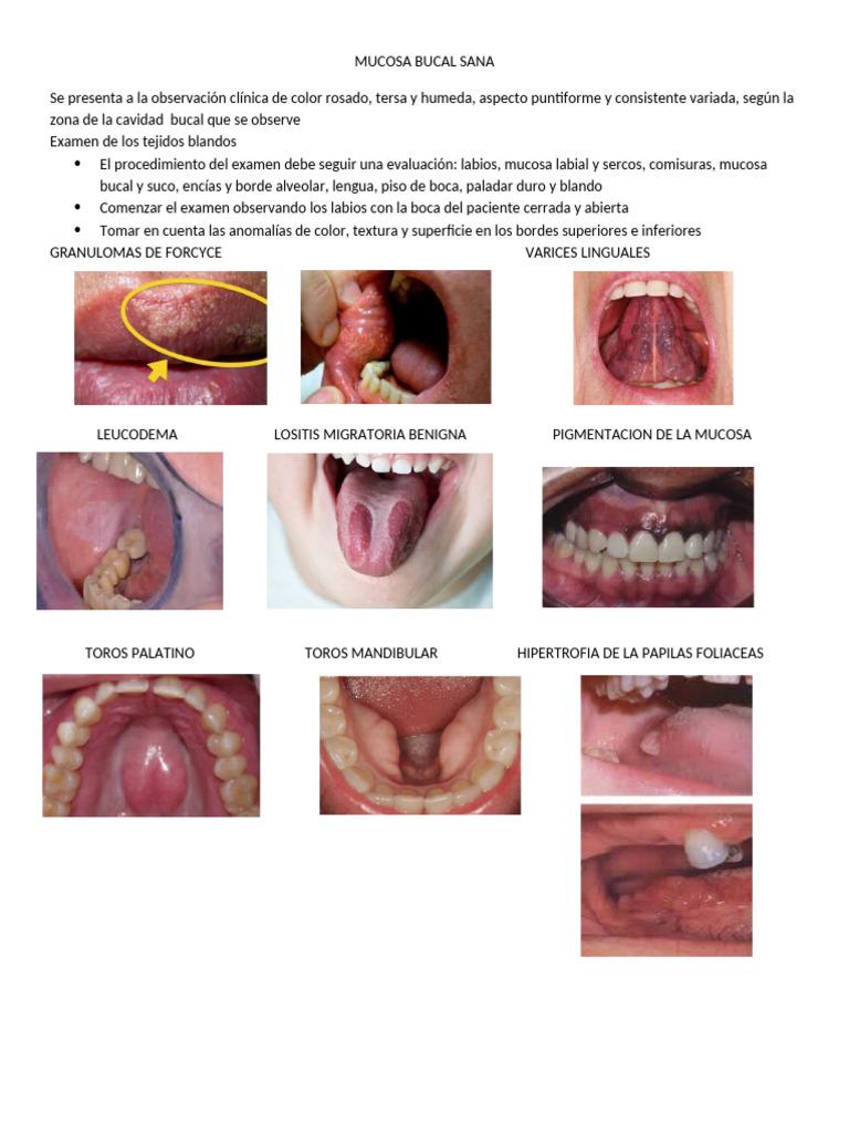 Giải phẫu bệnh miệng không chỉ là việc gọi tên các tổn thương mà là học cách quan sát và nhận diện chúng
