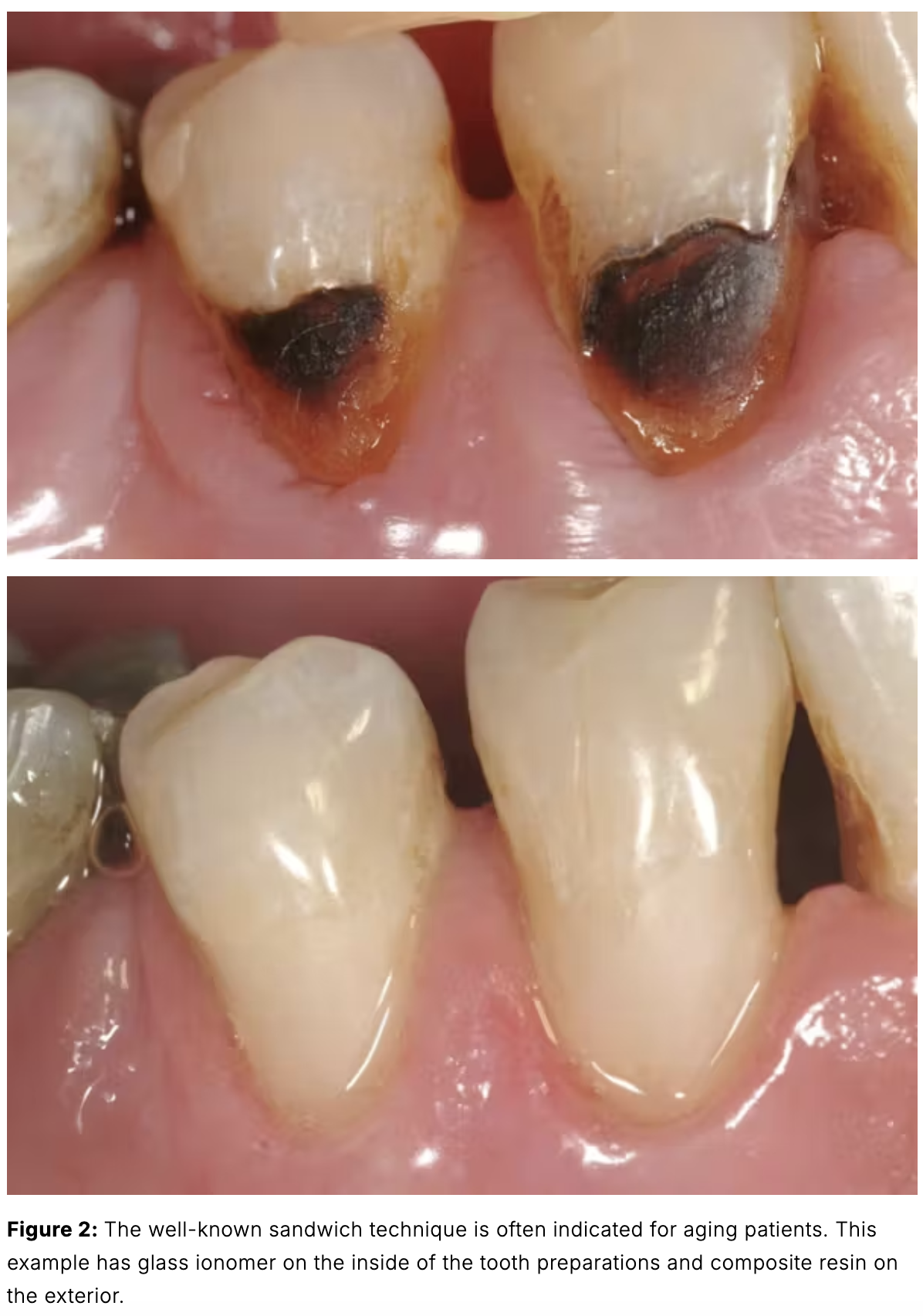 Điều trị nha khoa cho bệnh nhân lớn tuổi - bệnh nhân lão hóa