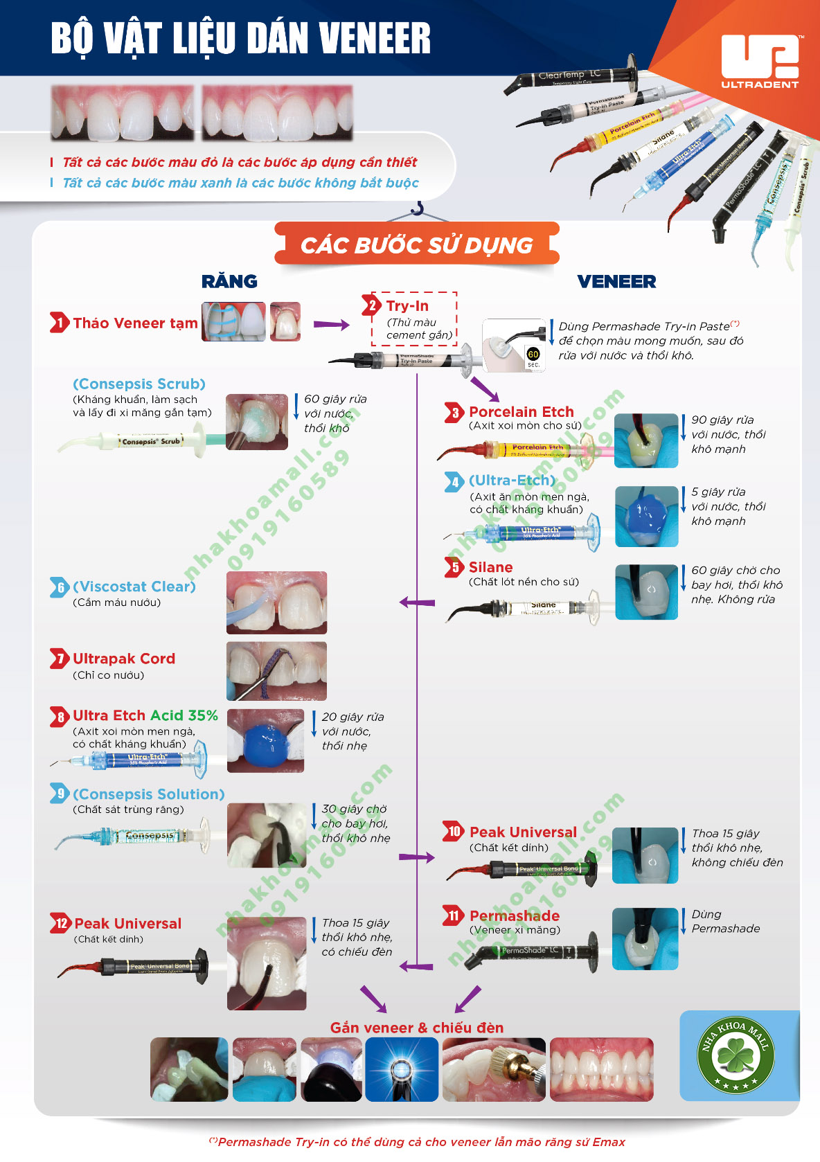 Các bước sử dụng bộ vật liệu gắn mặt dán sứ veneer của hãng Ultradent🌱NHA KHOA MALL🌱