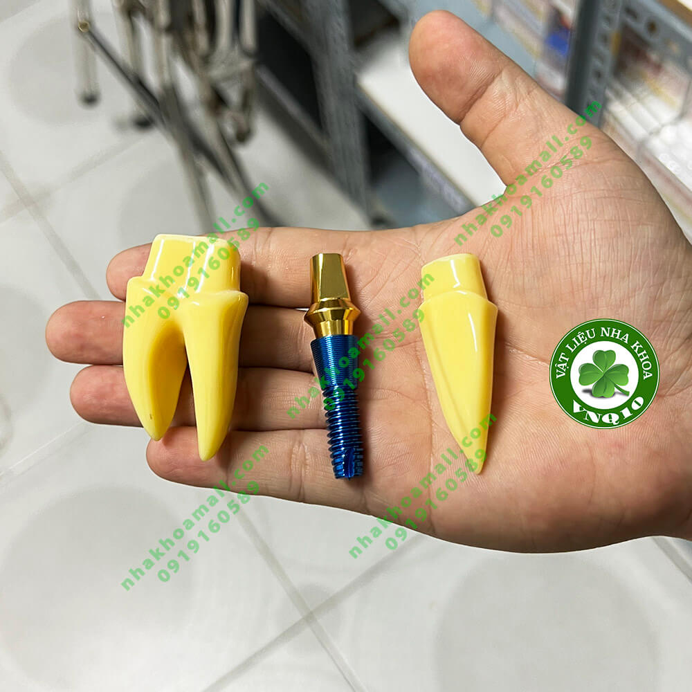 Mẫu Hàm Tư Vấn Implant: Công Cụ Trực Quan Giúp Bác Sĩ Nâng Cao Hiệu Quả Tư Vấn🌱NHA KHOA MALL🌱