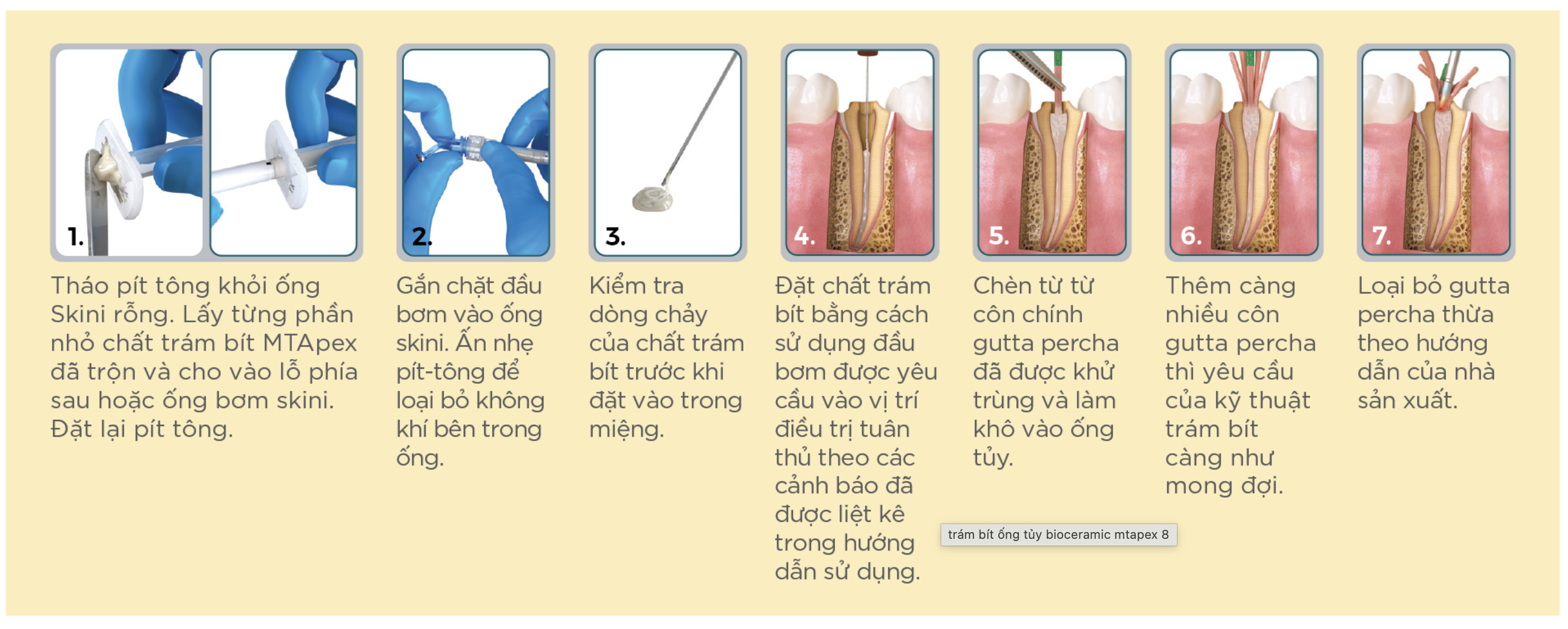 Trám bít ống tủy🌱Bioceramic Root Canal Sealer MTApex Ultradent GIÁ TỐT🌱NHA KHOA MALL🌱