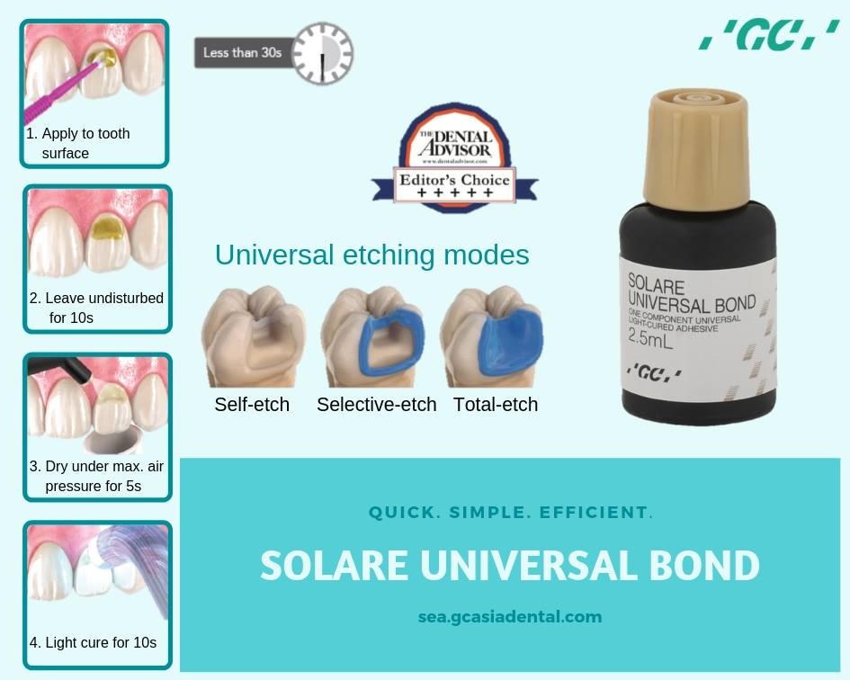 Bond 1 bước GC - Solare Universal Bond - Công nghệ đột phá giúp nâng tầm nha khoa thẩm mỹ