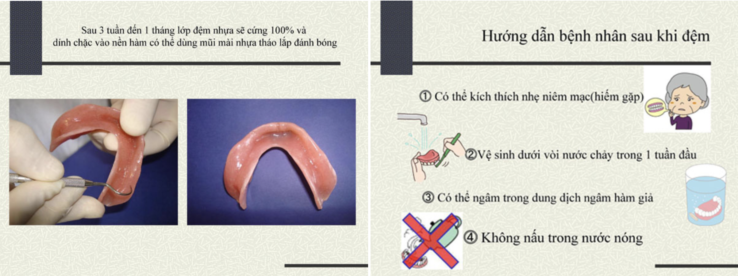 BỘ LỚN - Vật liệu đệm hàm giả tháo lắp DIL - KAMEMIZU CHEMICAL - Nhật Bản