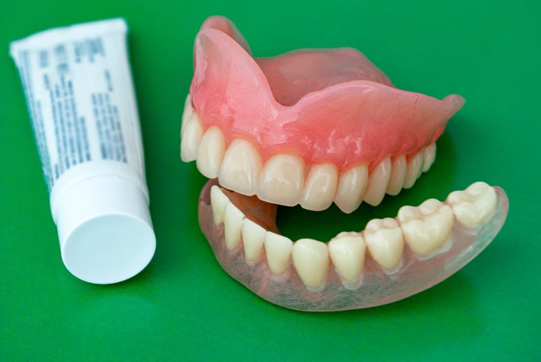Keo dán răng nha khoa có những loại nào? Tìm hiểu chi tiết nhất