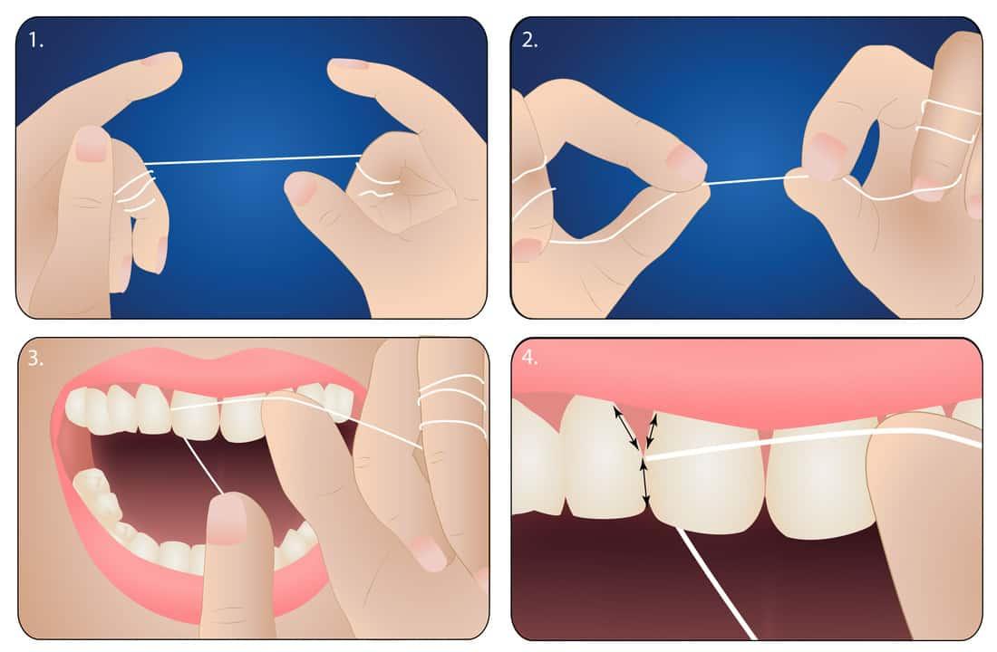 Cách dùng chỉ nha khoa đúng chuẩn: Hướng dẫn chi tiết từ A đến Z