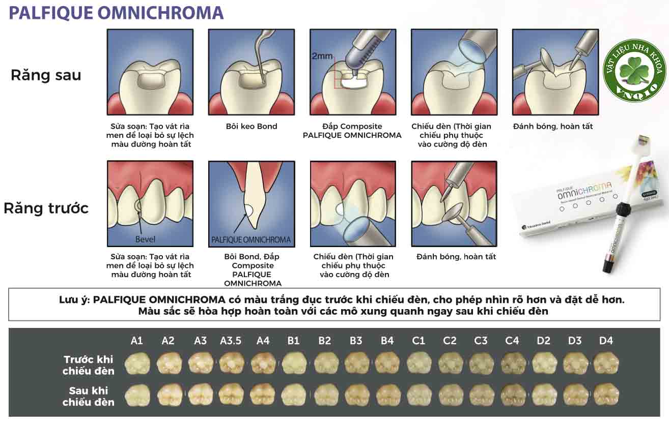 Composite lỏng trám răng đa năng Tokuyama Omnichroma Flow