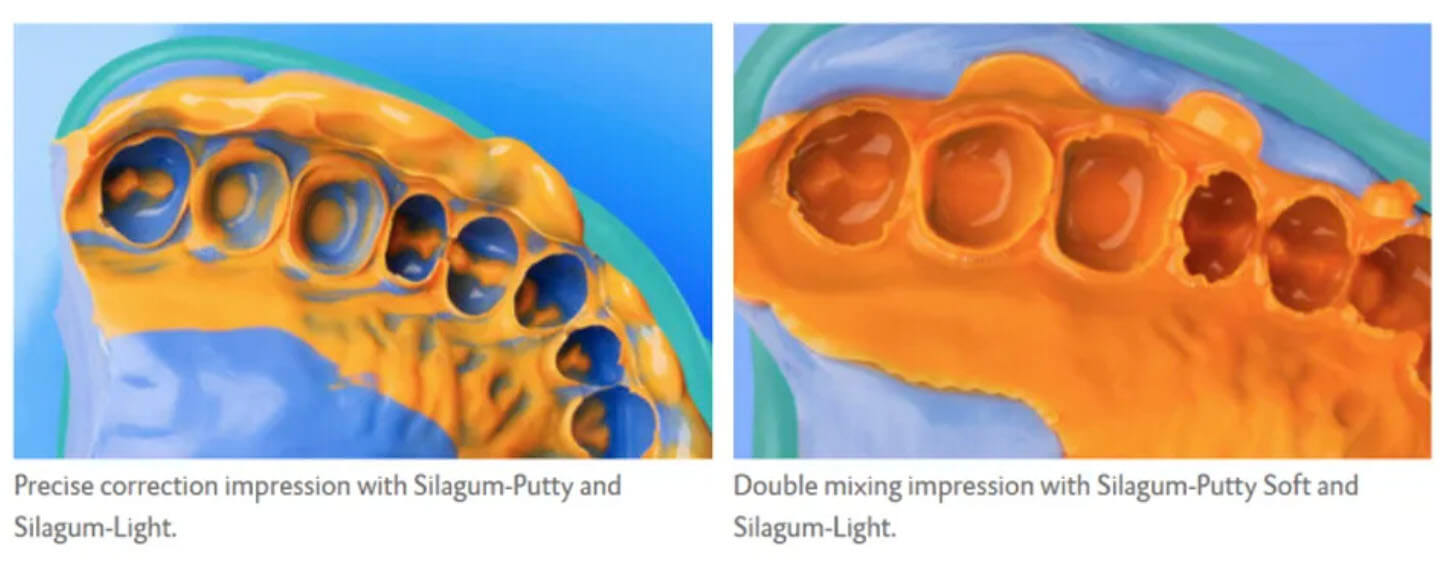 Cao su lỏng trộn súng Silagum Light AM DMG Đức 