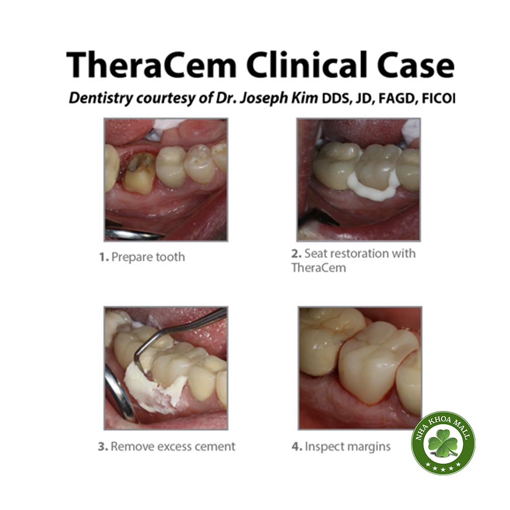 Xi măng gắn vĩnh viễn phục hình Zirconia TheraCem Bisco