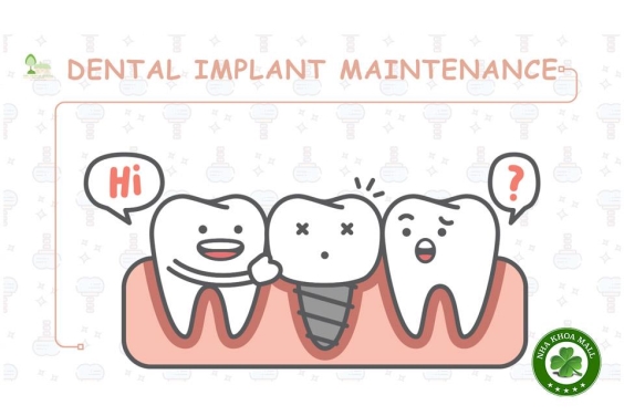 Cập nhật chăm sóc và bảo trì Implant nha khoa