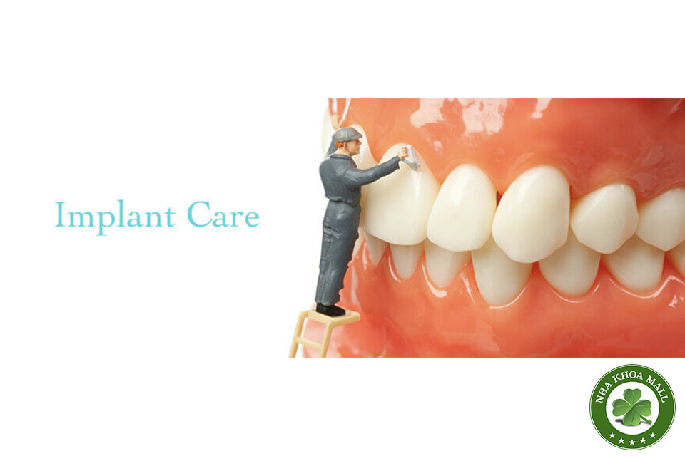Bệnh lý quanh implant: Phát hiện sớm và quản lý hiệu quả