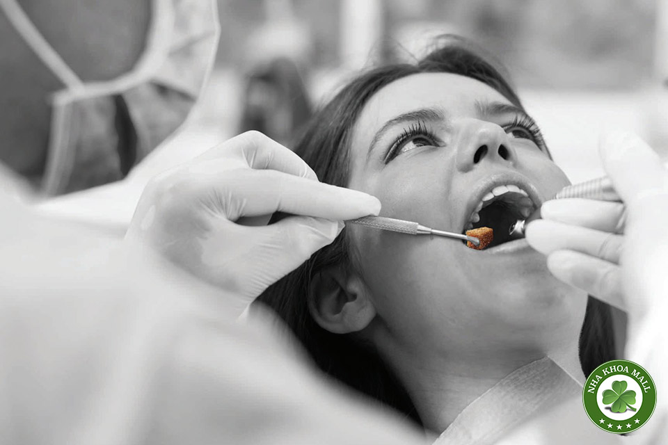 Vai trò của bông cầm máu dentospon trong thực hành nha khoa