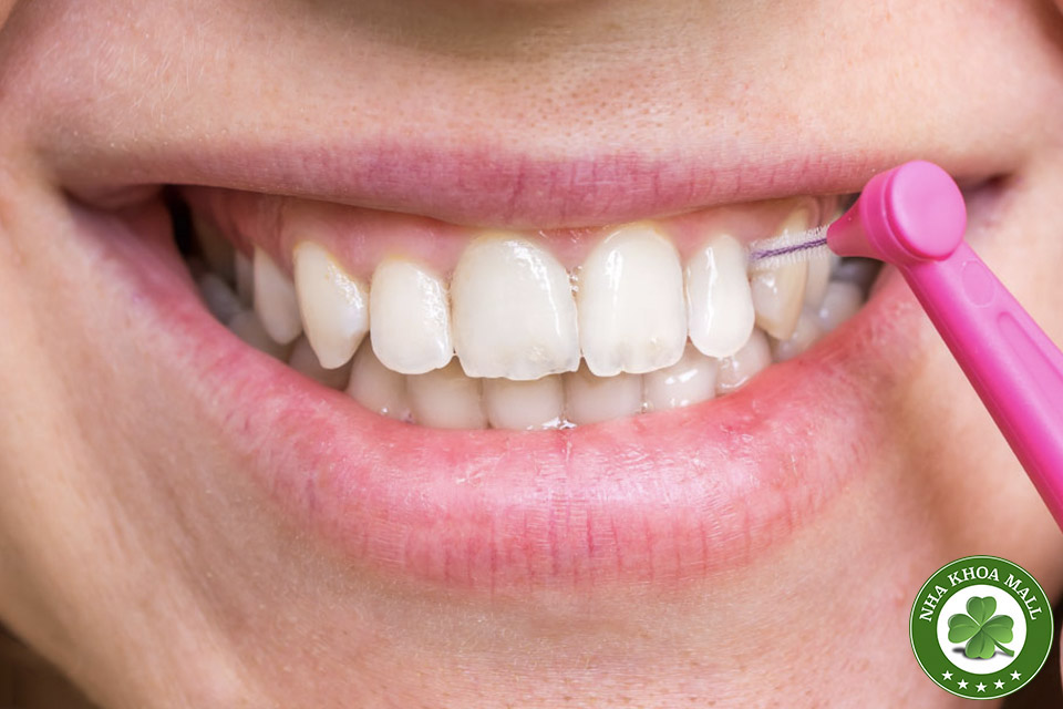 Bàn Chải Kẽ Răng Là Gì? Cách Sử Dụng Và Những Lợi Ích Cho Răng Miệng