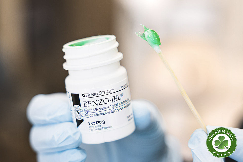Tê bôi Benzocaine và những lưu ý quan trọng khi gây tê bề mặt trong nha khoa