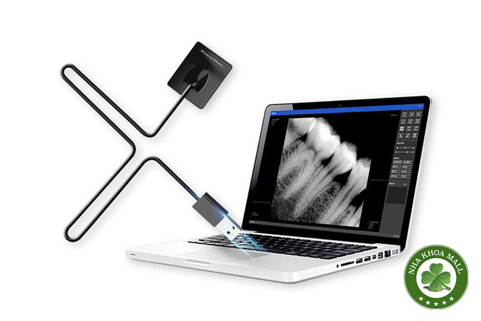 Sensor Kỹ thuật số Nha khoa là gì? Hướng dẫn chi tiết về công nghệ hiện đại trong nha khoa