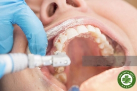 Bột đánh bóng không dầu Pumice: Bí quyết chăm sóc răng miệng tốt nhất