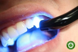 Các quy trình tốt nhất cho việc chuẩn bị răng để trám composite