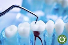 Vì sao cần điều trị nội nha? Giải pháp cứu răng hiệu quả