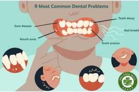 Các vấn đề răng miệng thường gặp: Hiểu biết, phòng ngừa và điều trị hiệu quả