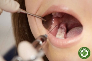 Gây Tê Vùng Trong Phẫu Thuật Răng: Kỹ Thuật và Nguyên Nhân Thất Bại