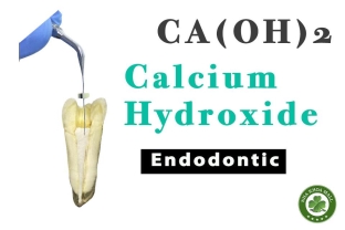 Calcium Hydroxide Trong Điều Trị Nội Nha - Tính Chất Và Quy Trình Đóng Chóp