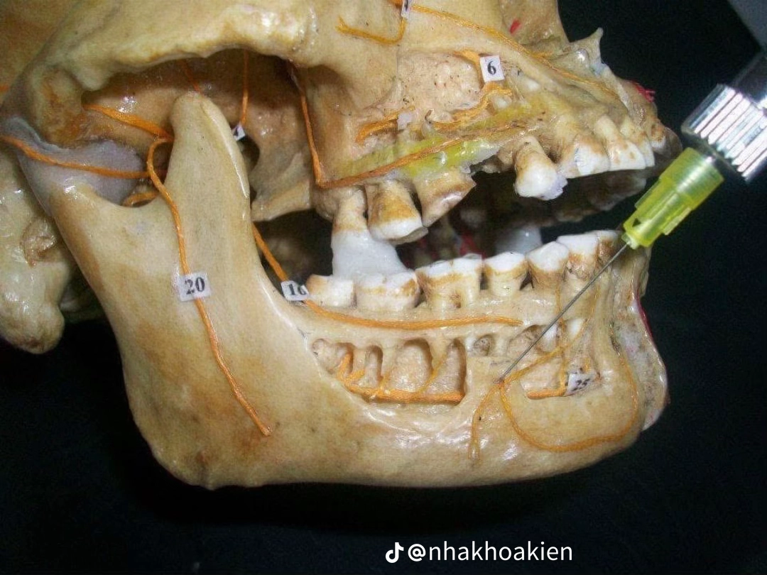 Vị trí 2