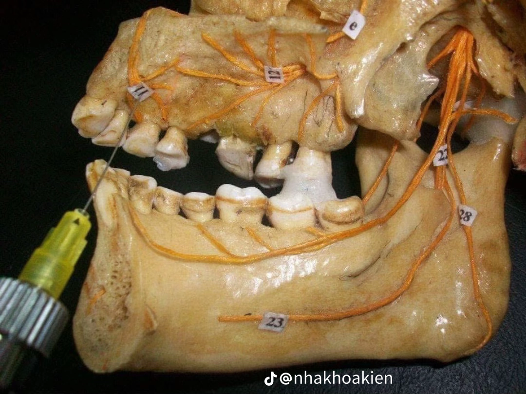 Vị trí 5
