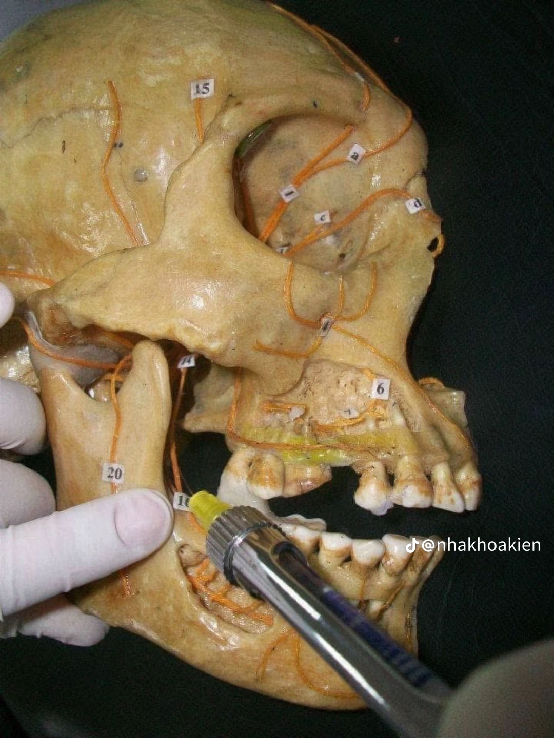 Vị trí 8
