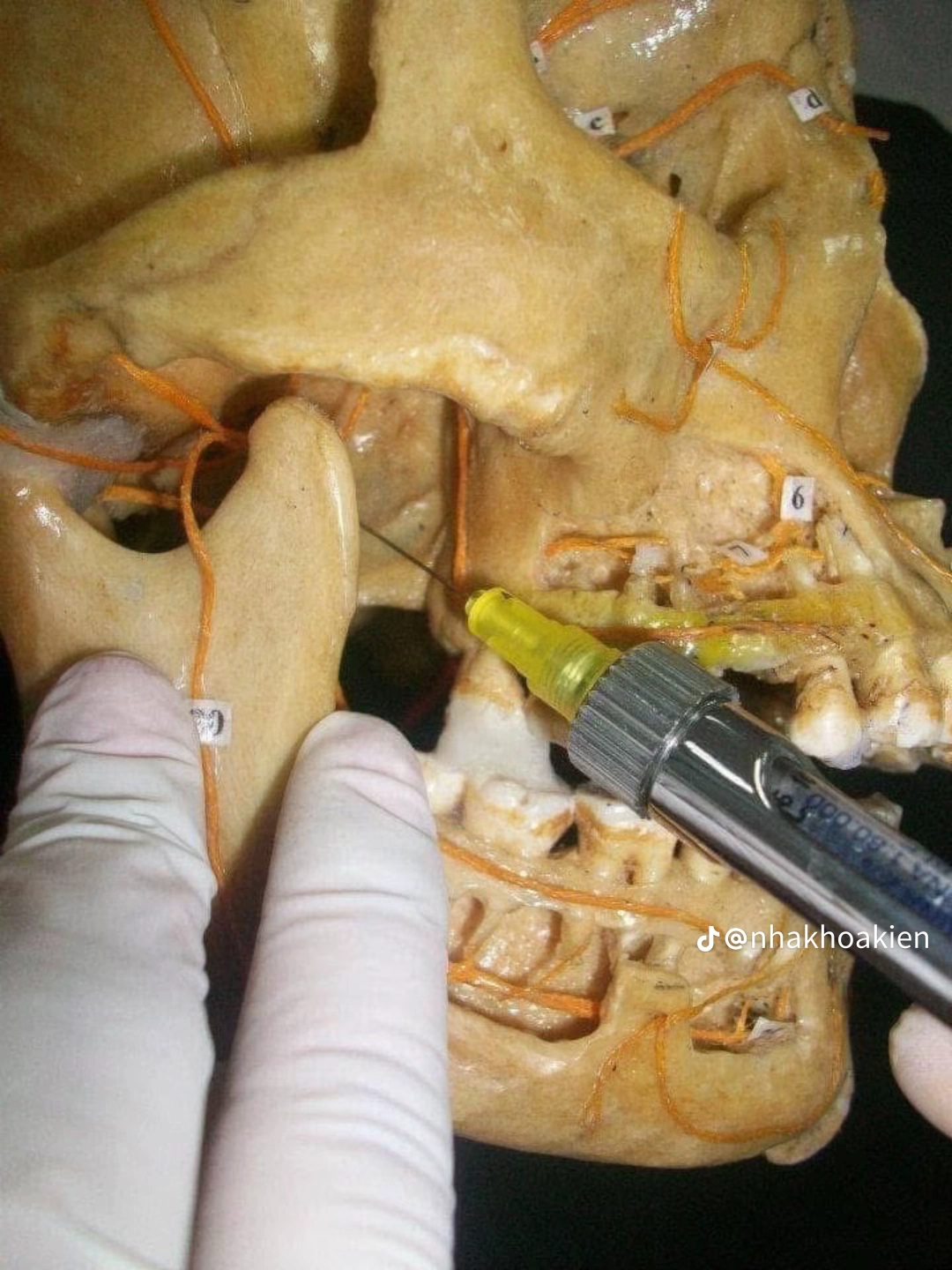 Vị trí 11
