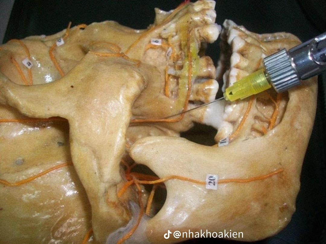 Vị trí 12