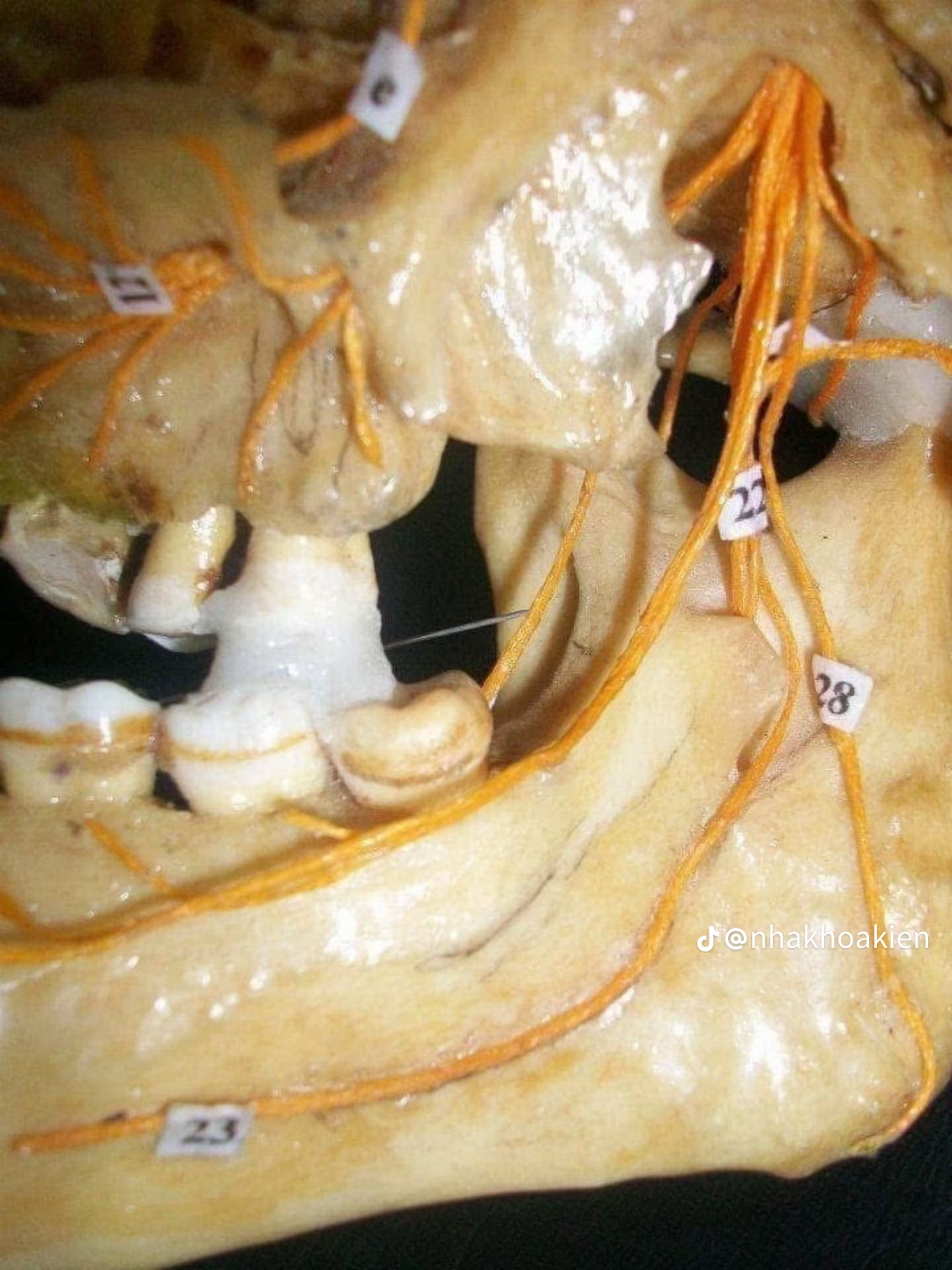 Vị trí 15