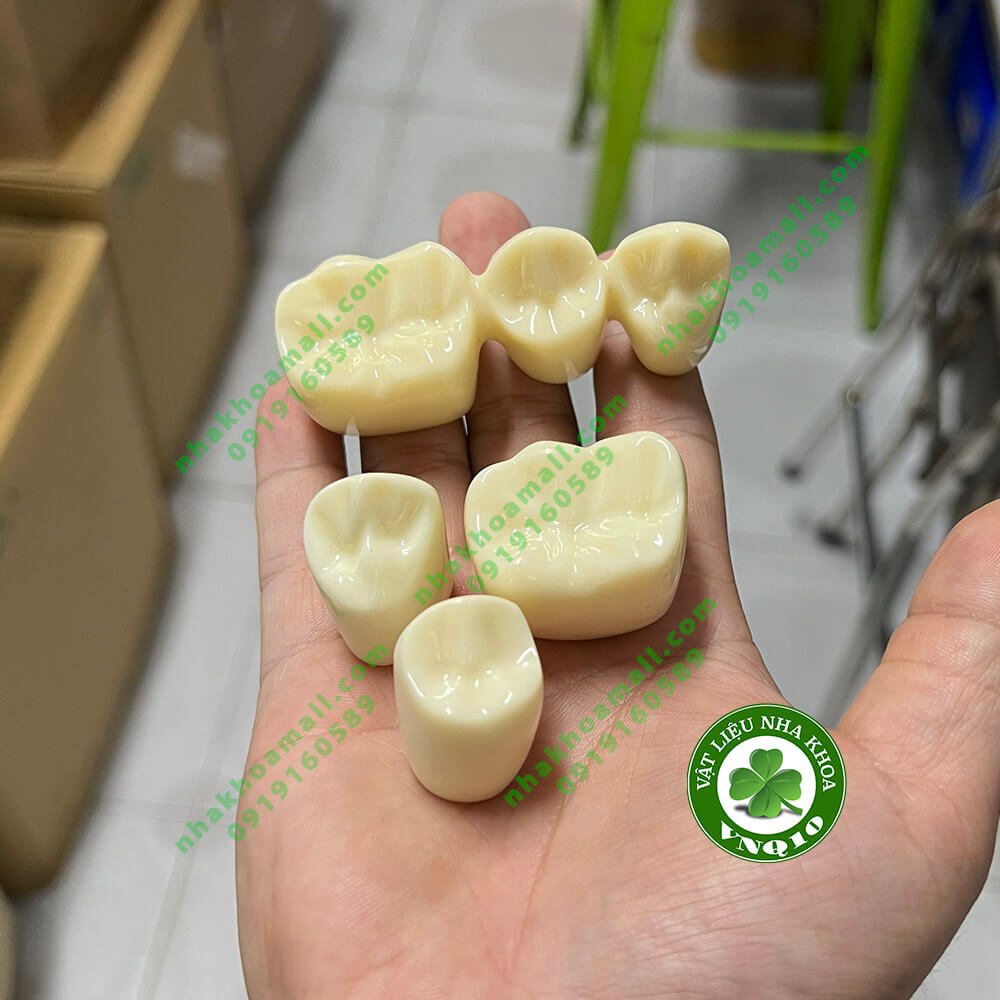 Mẫu hàm tư vấn so sánh răng cắm implant và cầu răng sứ