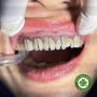Mũi cắt cầu mão kim loại - Zirconia Dentsply Transmetal Cylinder 19mm