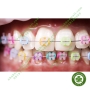 Thun cây gắn mắc cài UNISTICK nhiều màu AO American Orthodontics Mỹ