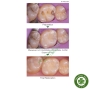 Composite lỏng PALFIQUE UNIVERSAL FLOW Super low Tokuyama