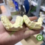 Dịch vụ lựa khâu chỉnh nha cho mẫu hàm thạch cao - khâu 1 ống, 2 ống