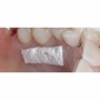 Spongel cầm máu collagen - Bông xốp cầm máu BBraun Lyostypt 5 x 8 cm