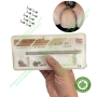 Bộ đê bảo vệ nướu khi mài cùi Zekrya Gingival Protector Kit Dentsply