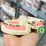 Mẫu hàm tư vấn chỉnh nha mắc cài kim loại và các loại khí cụ