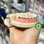 Mẫu hàm tư vấn chỉnh nha mắc cài kim loại và các loại khí cụ