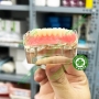 Mẫu hàm tư vấn implant All on 4 và phục hình tháo lắp trên implant