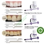 Composite đặc trám răng thẩm mỹ 3M Filtek Easy Match Universal Restorative