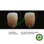 Composite đặc trám răng thẩm mỹ 3M Filtek Easy Match Universal Restorative