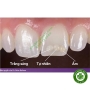 Composite đặc trám răng thẩm mỹ 3M Filtek Easy Match Universal Restorative